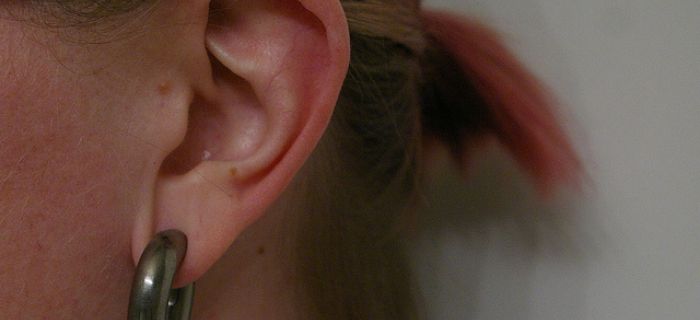 Izraubovane uši
